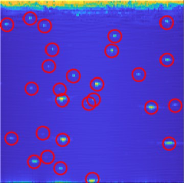 Ultrasound scan with detected features circled